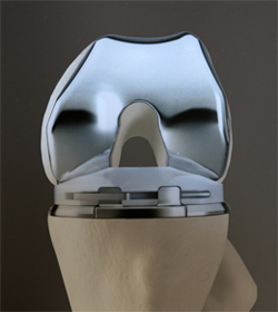 Biomet Vanguard Total Knee Replacement